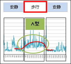 「ショーツのみ着用」のストレス値波形例