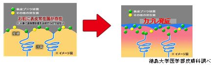 徳島大学医学部皮膚科調べ