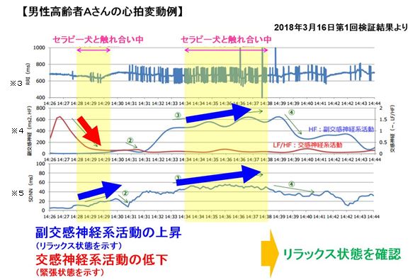 【男性高齢者Aさんの心拍変動例】